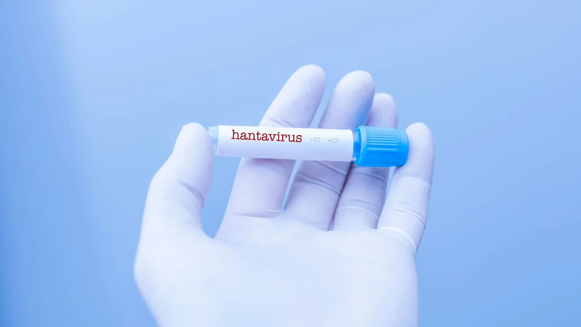 Is Hantavirus a Risk During Travel to Turkey?